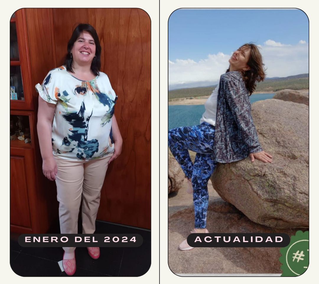 Fotos del antes y después de una paciente